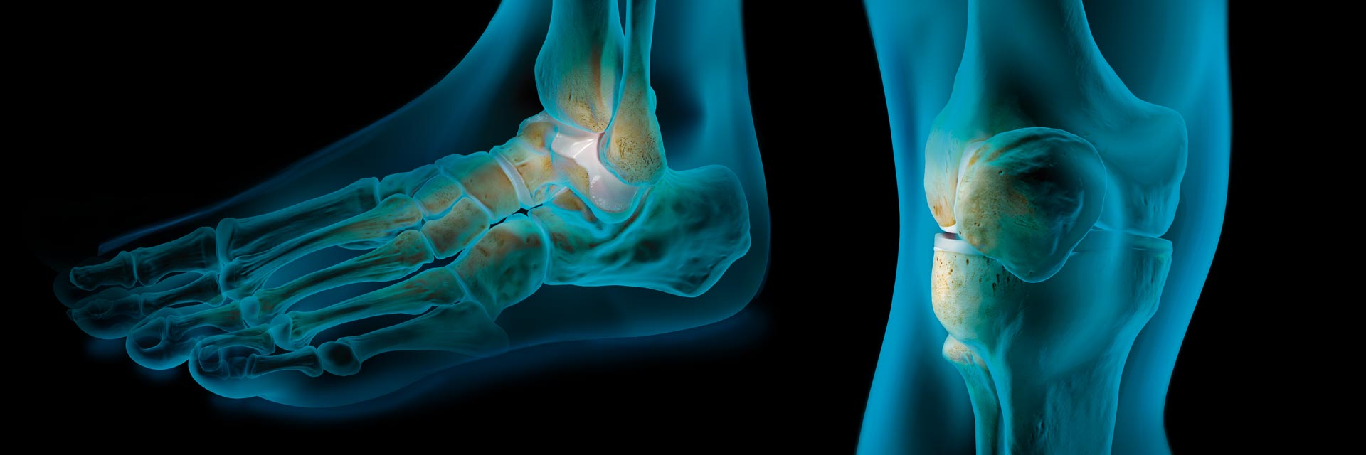 Arthrex Cours Membre Inférieur